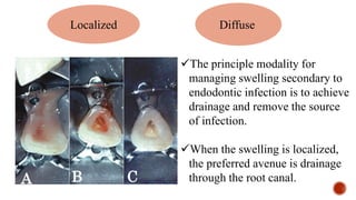 Localized Diffuse
The principle modality for
managing swelling secondary to
endodontic infection is to achieve
drainage and remove the source
of infection.
When the swelling is localized,
the preferred avenue is drainage
through the root canal.
A C
B
 