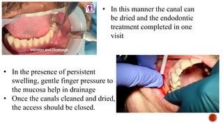 • In this manner the canal can
be dried and the endodontic
treatment completed in one
visit
• In the presence of persistent
swelling, gentle finger pressure to
the mucosa help in drainage
• Once the canals cleaned and dried,
the access should be closed.
 