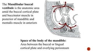 The Mandibular buccal
vestibule is the anatomic area
amid the buccal cortical plate
and buccinator muscle in
posterior of mandible and
mentalis muscle in anteriors
Space of the body of the mandible:
Area between the buccal or lingual
cortical plate and overlying periosteum
 