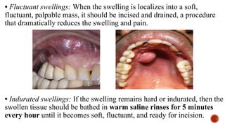• Fluctuant swellings: When the swelling is localizes into a soft,
fluctuant, palpable mass, it should be incised and drained, a procedure
that dramatically reduces the swelling and pain.
• Indurated swellings: If the swelling remains hard or indurated, then the
swollen tissue should be bathed in warm saline rinses for 5 minutes
every hour until it becomes soft, fluctuant, and ready for incision.
 