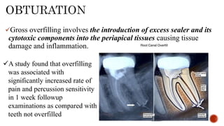 Gross overfilling involves the introduction of excess sealer and its
cytotoxic components into the periapical tissues causing tissue
damage and inflammation.
A study found that overfilling
was associated with
significantly increased rate of
pain and percussion sensitivity
in 1 week followup
examinations as compared with
teeth not overfilled
 