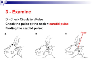 First Aid Training in engineering industries | PPT