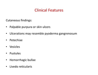 Cutaneous findings:
• Palpable purpura or skin ulcers
• Ulcerations may resemble pyoderma gangrenosum
• Petechiae
• Vesicles
• Pustules
• Hemorrhagic bullae
• Livedo reticularis
Clinical Features
 