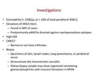 Investigations
• Eosinophilia (> 1500/µL or > 10% of total peripheral WBCs)
• Elevations of ANCA titers
– Found in 40% of cases
– Predominantly pANCAs directed against myeloperoxidase epitopes
• High ESR
• CXR/CT
– Normal or can have infiltrates
• Biopsy
– Specimens of skin, lymph nodes, lung parenchyma, or peripheral
nerve
– Demonstrate the characteristic vasculitis
– Kidney biopsy sample may show segmental necrotizing
glomerulonephritis with crescent formation in RPGN
 