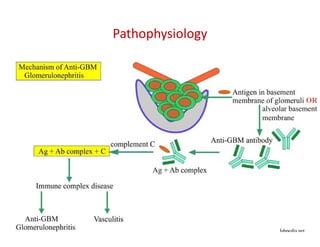 Pathophysiology
alveolar basement
membrane
OR
 