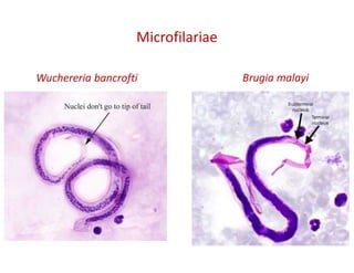 Microfilariae
Wuchereria bancrofti Brugia malayi
 