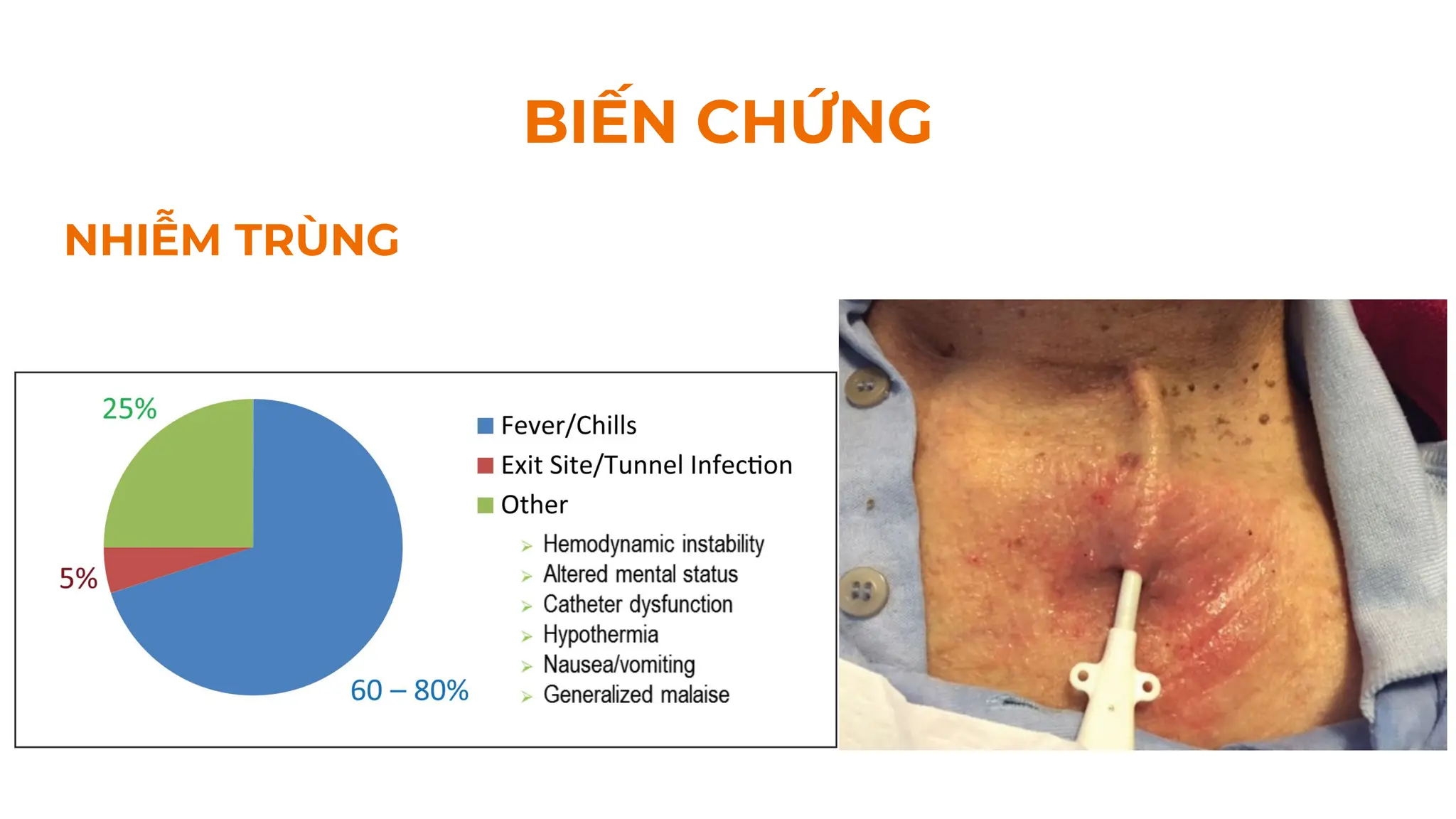 NHIỄM TRÙNG
BIẾN CHỨNG
 