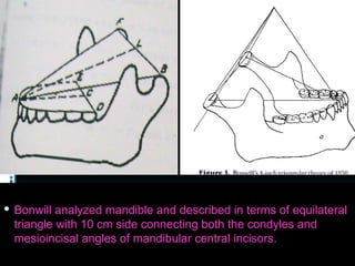 Bonwill 10. Occlusion and it's types in complete dentures | PDF