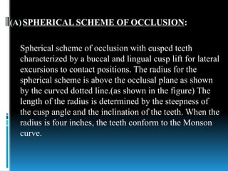 10. Occlusion and it's types in complete dentures | PDF