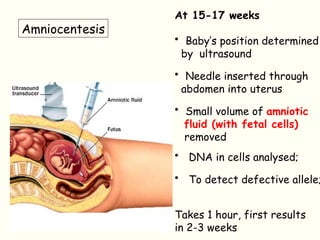 At 15-17 weeks
• Baby’s position determined
by ultrasound
• Needle inserted through
abdomen into uterus
• Small volume of amniotic
fluid (with fetal cells)
removed
• DNA in cells analysed;
• To detect defective allele;
Takes 1 hour, first results
in 2-3 weeks
Amniocentesis
 