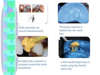 Both materials are
mixed simultaneously
The putty material is
loaded into the stock
tray
the light body material is
syringed around the tooth
preparation
a full mouth Impression is
made using the loaded
stock tray
 