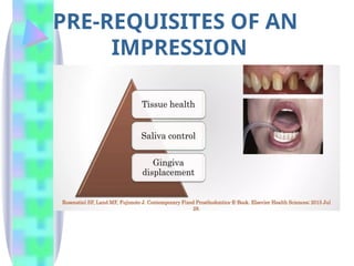 PRE-REQUISITES OF AN
IMPRESSION
 