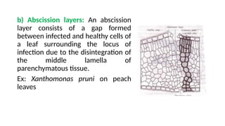 10. DEFENSE MECHANISMS IN PLANTS.ppt pathology | PPTX