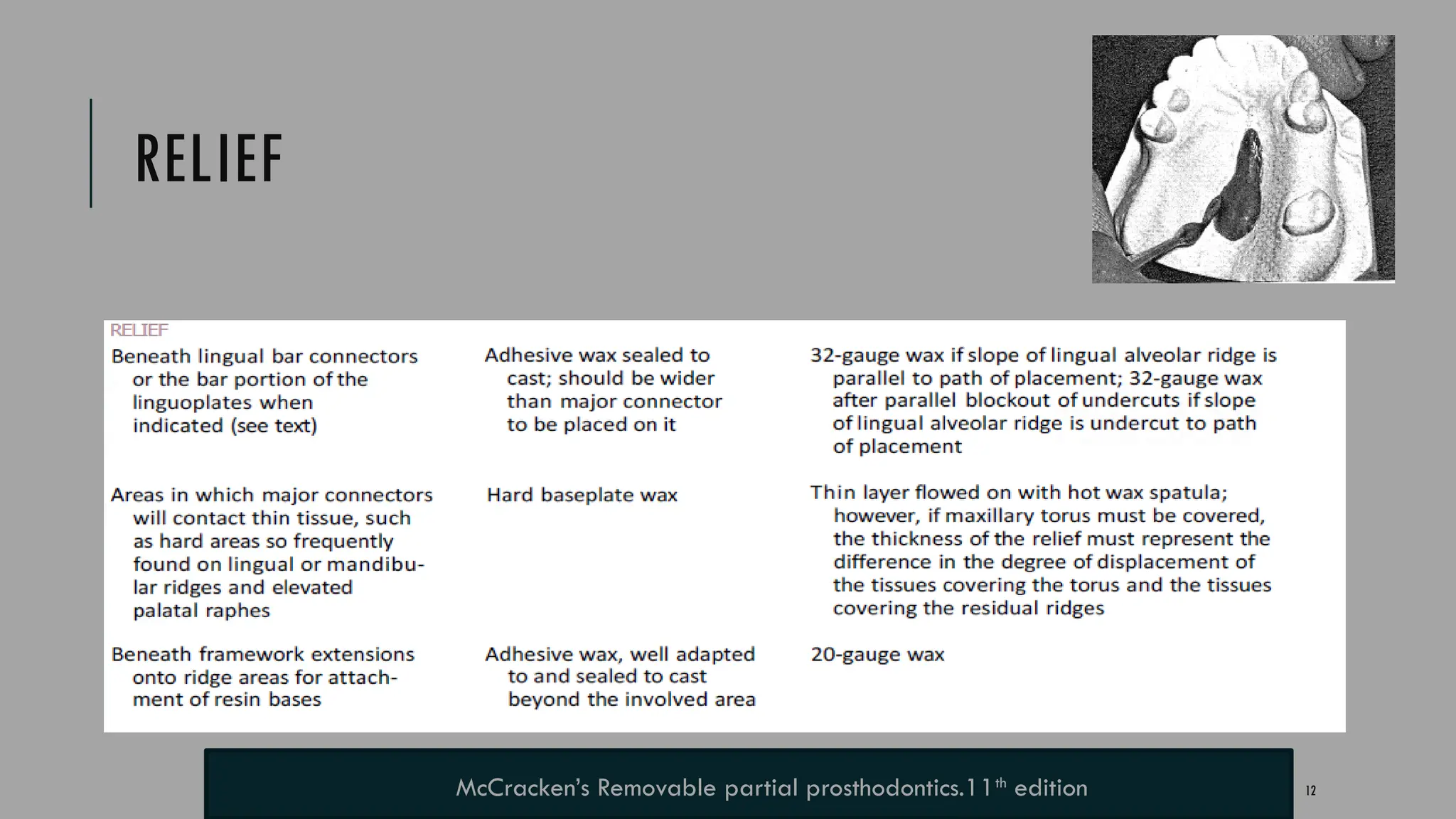 12
RELIEF
McCracken’s Removable partial prosthodontics.11th
edition
 