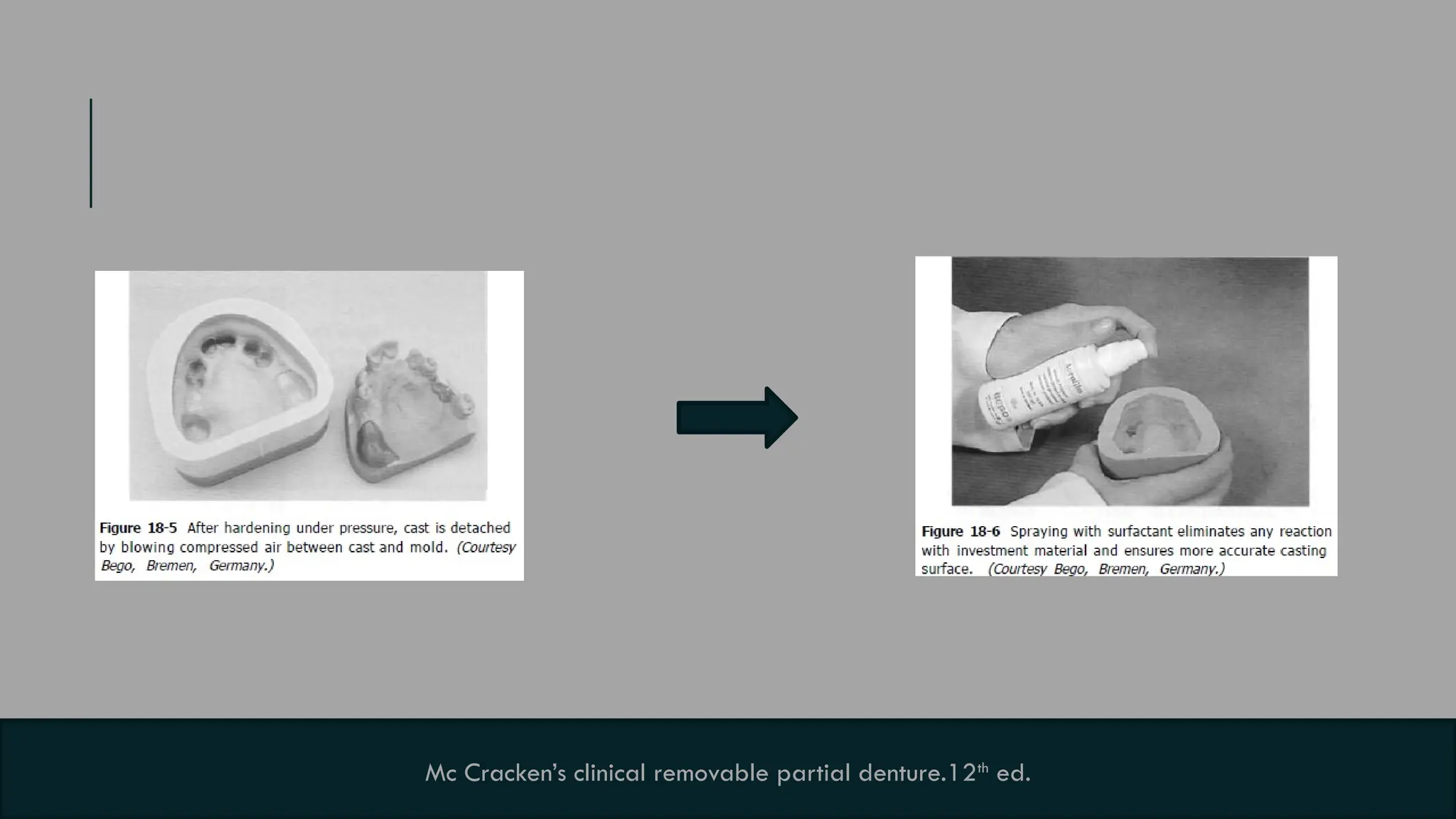 17
Mc Cracken’s clinical removable partial denture.12th
ed.
 