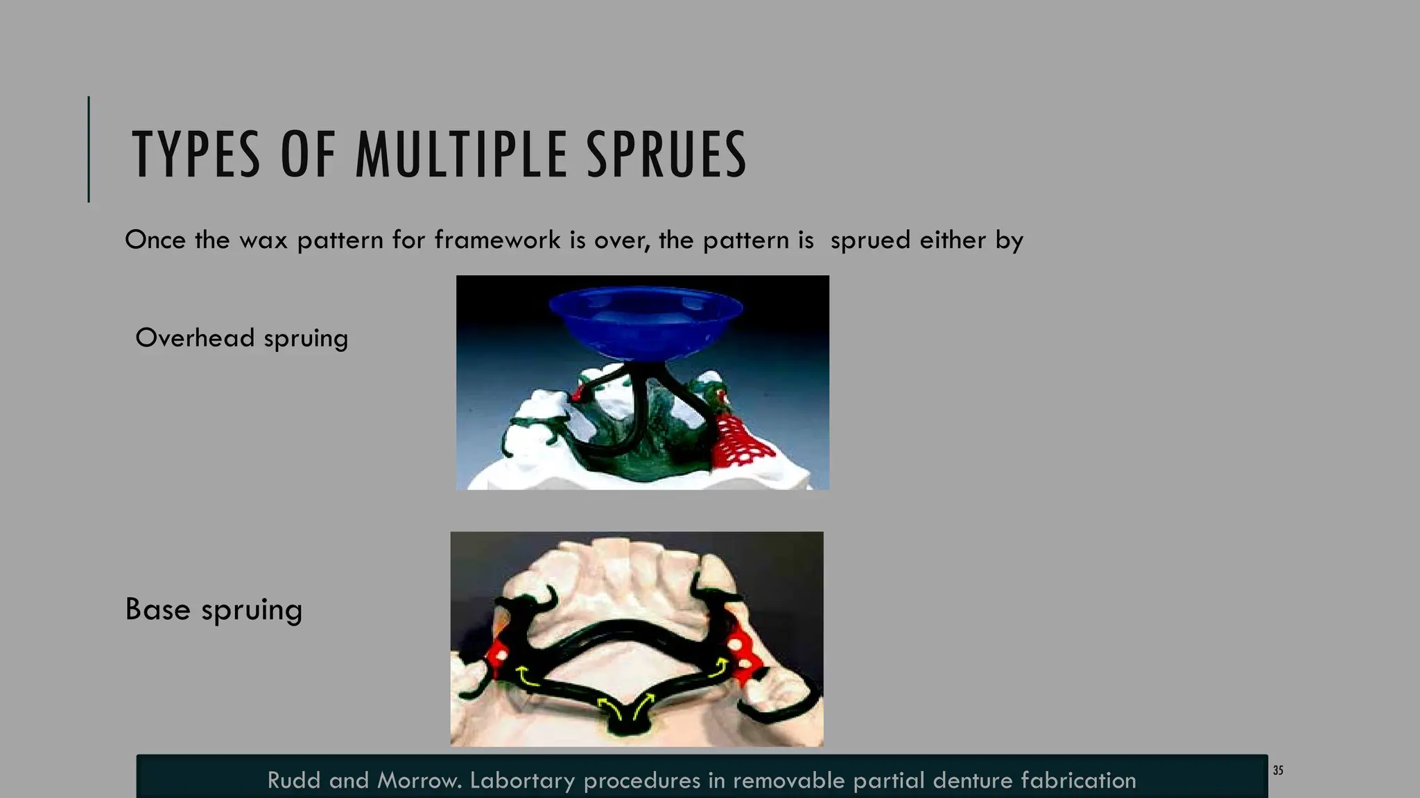 35
TYPES OF MULTIPLE SPRUES
Once the wax pattern for framework is over, the pattern is sprued either by
Overhead spruing
Base spruing
Rudd and Morrow. Labortary procedures in removable partial denture fabrication
 
