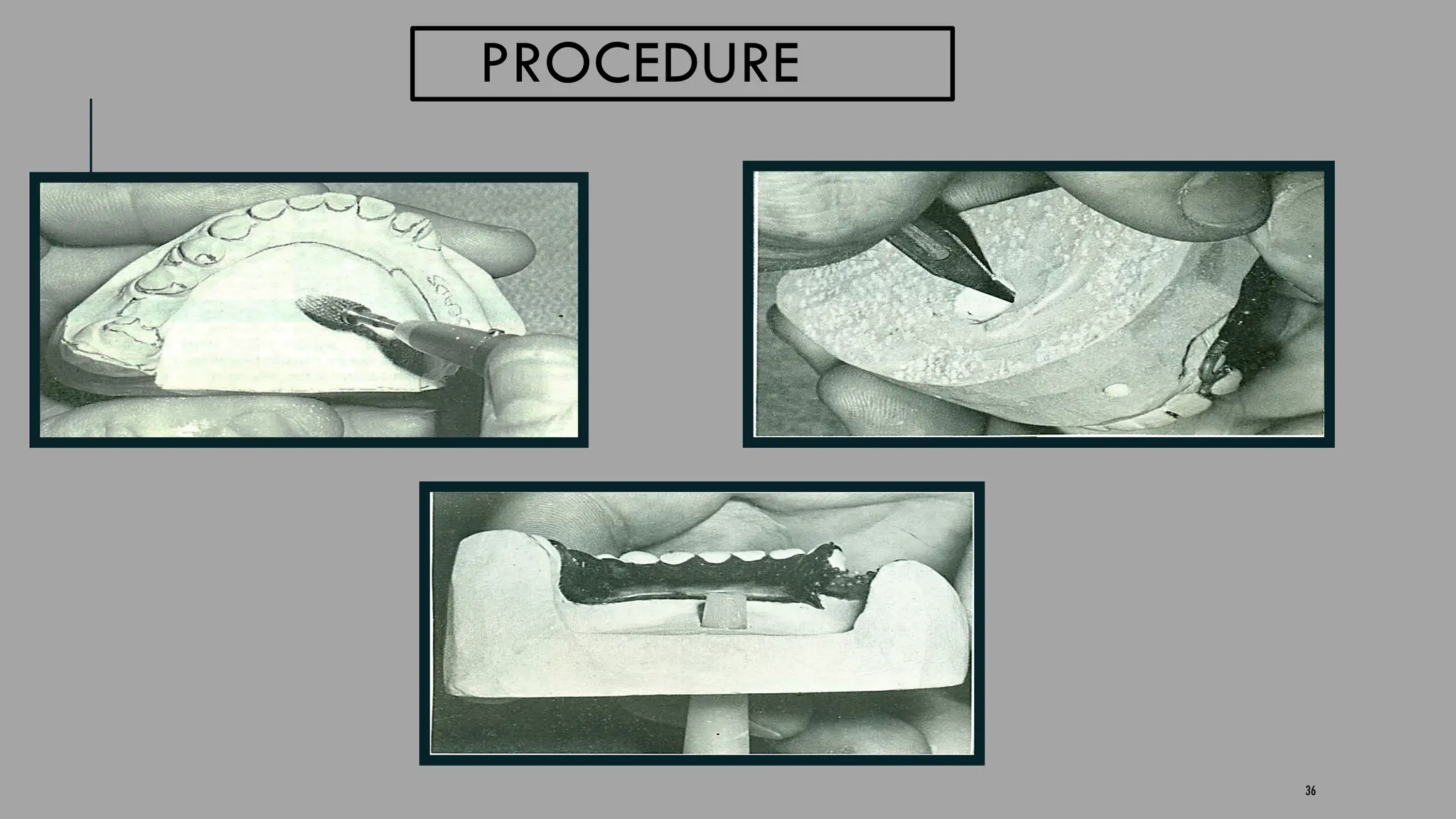 36
PROCEDURE
 