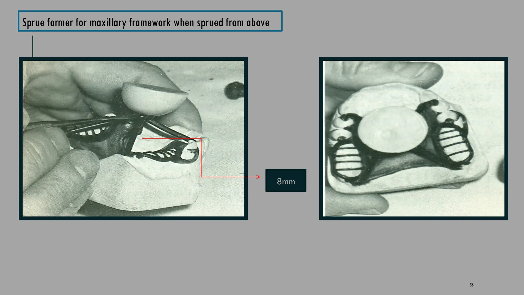 38
Sprue former for maxillary framework when sprued from above
8mm
 
