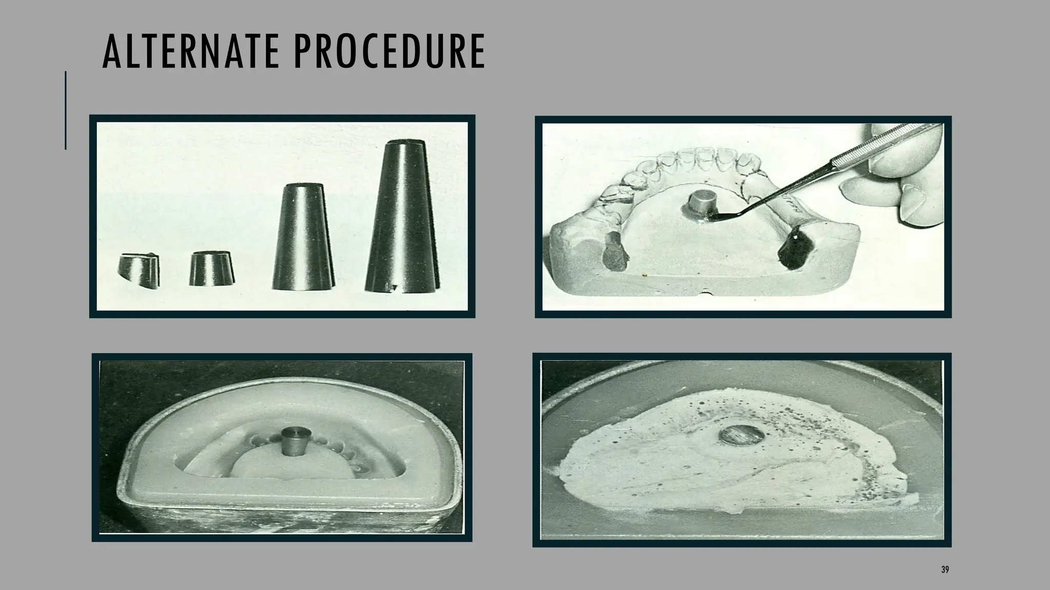 39
ALTERNATE PROCEDURE
 