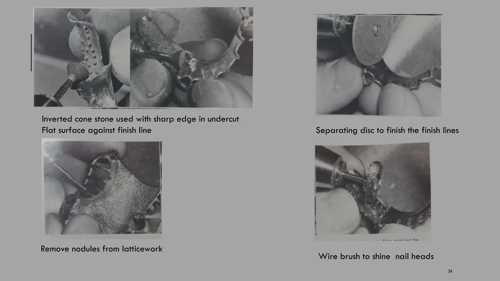 54
Inverted cone stone used with sharp edge in undercut
Flat surface against finish line Separating disc to finish the finish lines
Remove nodules from latticework
Wire brush to shine nail heads
 