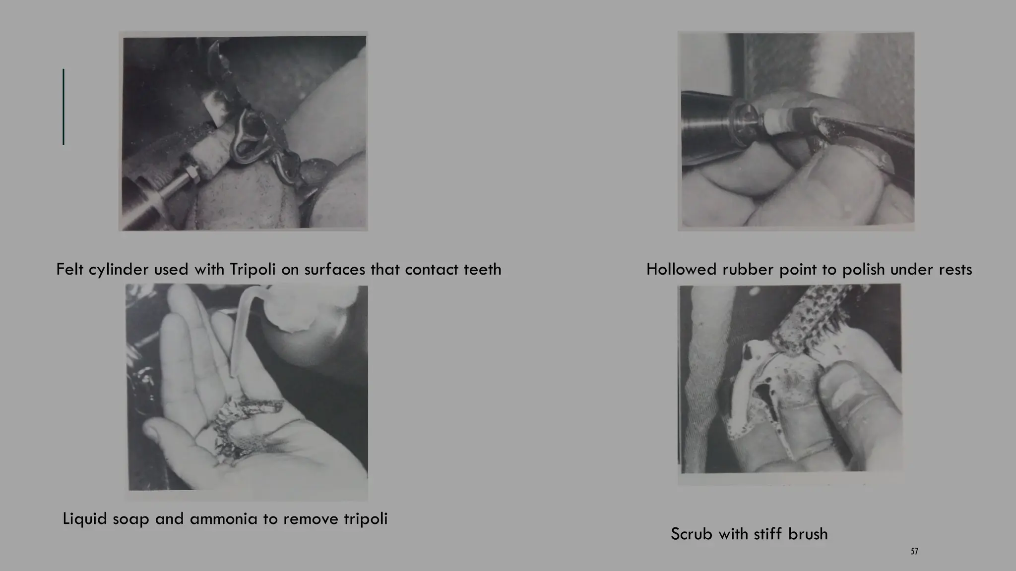 57
Felt cylinder used with Tripoli on surfaces that contact teeth Hollowed rubber point to polish under rests
Liquid soap and ammonia to remove tripoli
Scrub with stiff brush
 