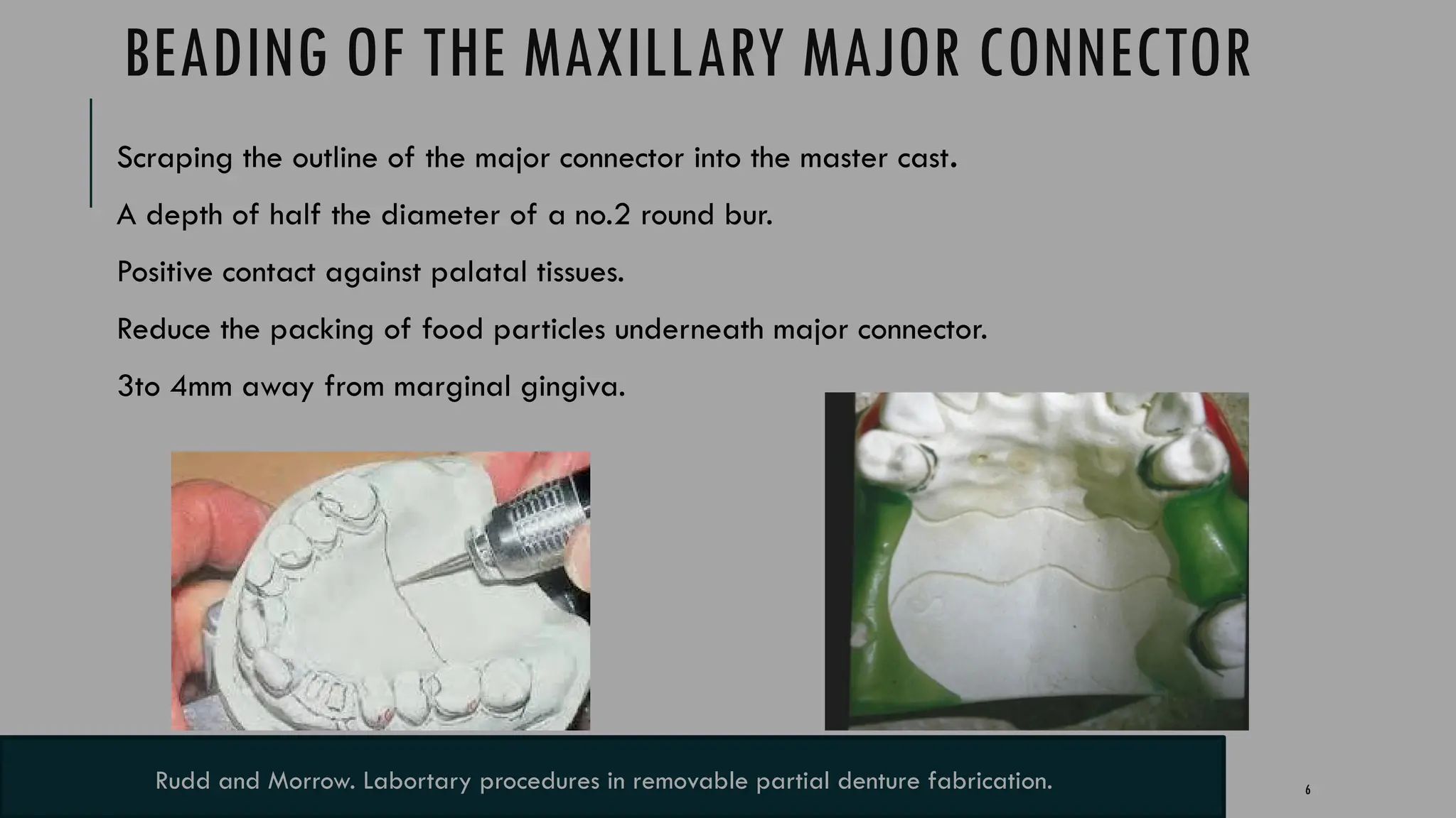 6
BEADING OF THE MAXILLARY MAJOR CONNECTOR
Scraping the outline of the major connector into the master cast.
A depth of half the diameter of a no.2 round bur.
Positive contact against palatal tissues.
Reduce the packing of food particles underneath major connector.
3to 4mm away from marginal gingiva.
Rudd and Morrow. Labortary procedures in removable partial denture fabrication.
 