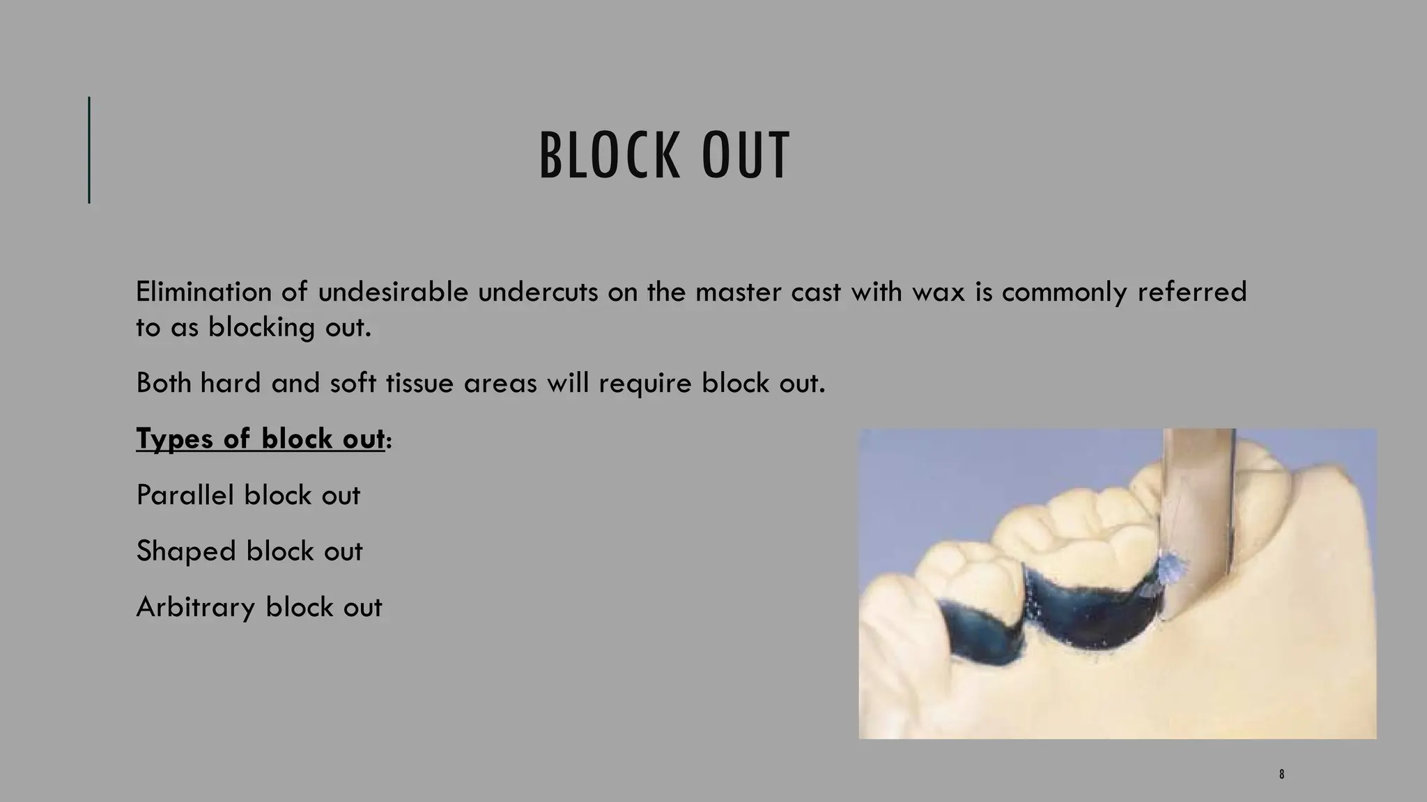 8
BLOCK OUT
Elimination of undesirable undercuts on the master cast with wax is commonly referred
to as blocking out.
Both hard and soft tissue areas will require block out.
Types of block out:
Parallel block out
Shaped block out
Arbitrary block out
 