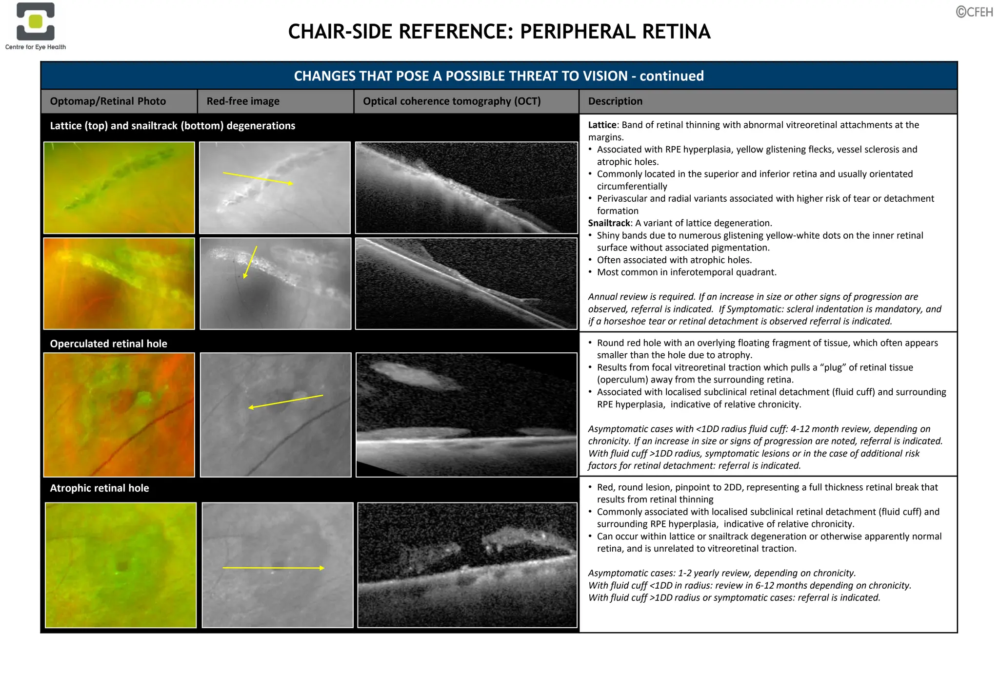 10. PERIPHERAL-RETINA.pdf of the diseases | PDF