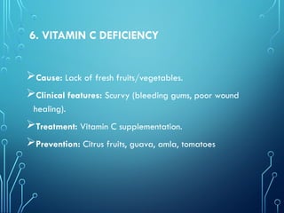 6. VITAMIN C DEFICIENCY
Cause: Lack of fresh fruits/vegetables.
Clinical features: Scurvy (bleeding gums, poor wound
healing).
Treatment: Vitamin C supplementation.
Prevention: Citrus fruits, guava, amla, tomatoes
 