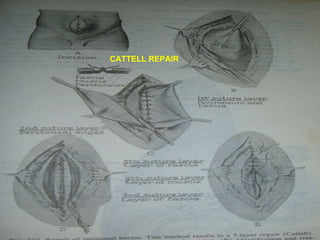 CATTELL REPAIR 