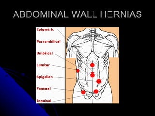 ABDOMINAL WALL HERNIAS 