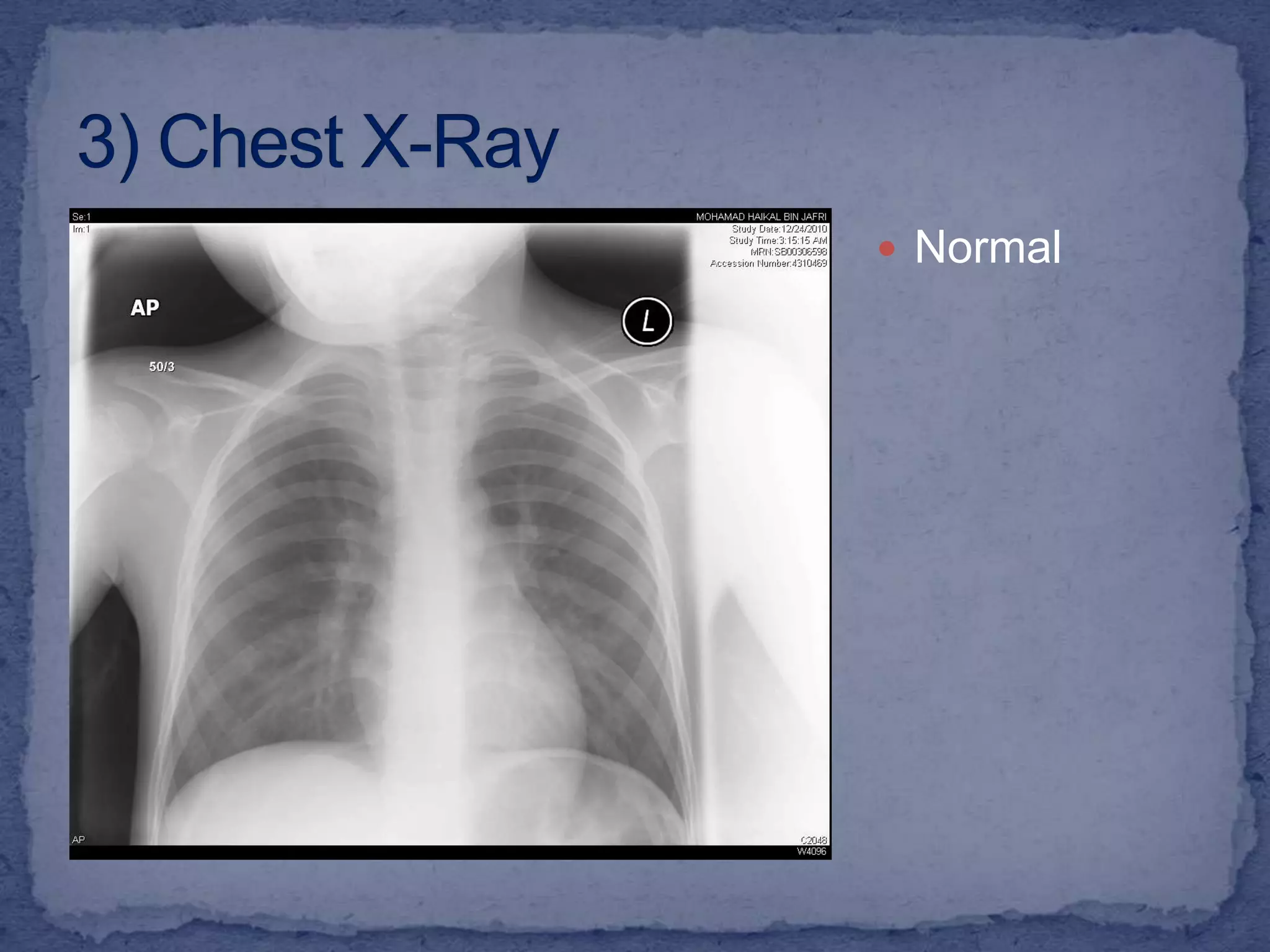 1) Full Blood Count and automated differentials