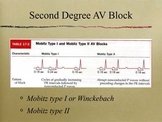 10 av-blocks | PPT