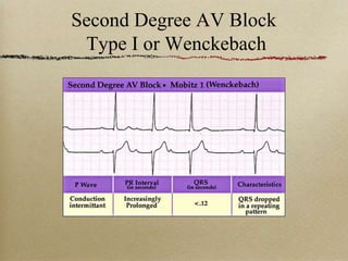 Type I Block 10-AV-blocks.ppt