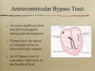 Tact Accessory 10-AV-blocks.ppt
