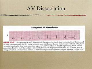 10-AV-blocks.ppt