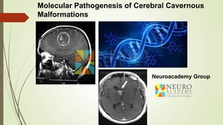 Molecular Pathogenesis of Cerebral Cavernous
Malformations
Neuroacademy Group
 