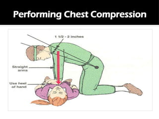 10-CPR cardiopulmonary resuscitation.pptx