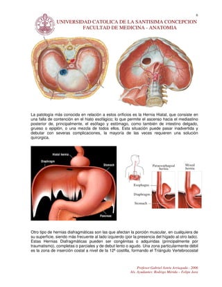 6
              UNIVERSIDAD CATOLICA DE LA SANTISIMA CONCEPCION
                       FACULTAD DE MEDICINA - ANATOMIA




La patología más conocida en relación a estos orificios es la Hernia Hiatal, que consiste en
una falla de contención en el hiato esofágico; lo que permite el ascenso hacia el mediastino
posterior de, principalmente, el esófago y estómago, como también de intestino delgado,
grueso o epiplón, o una mezcla de todos ellos. Esta situación puede pasar inadvertida y
debutar con severas complicaciones, la mayoría de las veces requieren una solución
quirúrgica.




Otro tipo de hernias diafragmáticas son las que afectan la porción muscular, en cualquiera de
su superficie, siendo más frecuente al lado izquierdo (por la presencia del hígado al otro lado).
Estas Hernias Diafragmáticas pueden ser congénitas o adquiridas (principalmente por
traumatismo), completas o parciales y de debut lento o agudo. Una zona particularmente débil
es la zona de inserción costal a nivel de la 12ª costilla, formando el Triángulo Vertebrocostal



                                                              Profesor Gabriel Astete Arriagada - 2006
                                                         Als. Ayudantes: Rodrigo Mérida – Felipe Jara
 