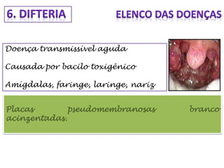 Doença transmissível aguda
Causada por bacilo toxigênico
Amígdalas, faringe, laringe, nariz
Placas pseudomembranosas branco
acinzentadas.
 