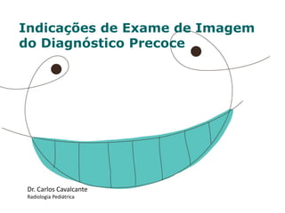 Indicações de Exame de Imagem 
do Diagnóstico Precoce 
Dr. Carlos Cavalcante 
Radiologia Pediátrica  