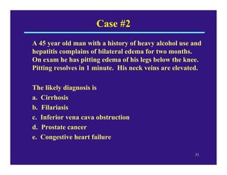Case #2
A 45 year old man with a history of heavy alcohol use and
hepatitis complains of bilateral edema for two months.
On exam he has pitting edema of his legs below the knee.
Pitting resolves in 1 minute. His neck veins are elevated.

The likely diagnosis is
a. Cirrhosis
b. Filariasis
c. Inferior vena cava obstruction
d. Prostate cancer
e. Congestive heart failure

                                                       31
 