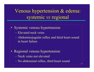 Venous hypertension & edema:
      systemic vs regional
• Systemic venous hypertension
  – Elevated neck veins
  – Abdomin...