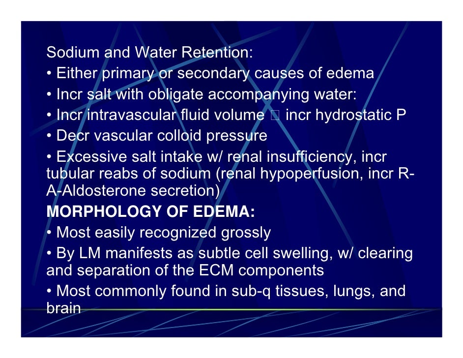 Edema