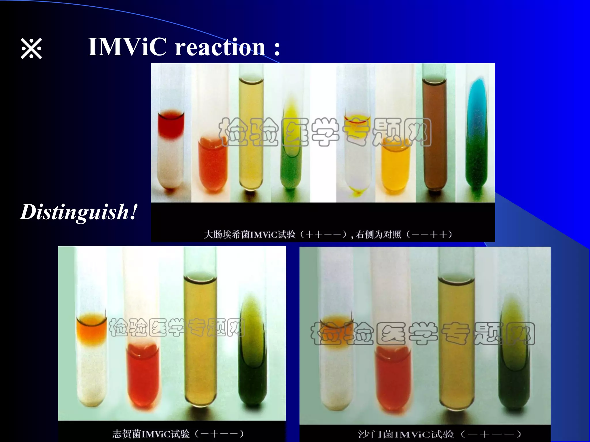 ※ 　 IMViC reaction :
Distinguish!
 