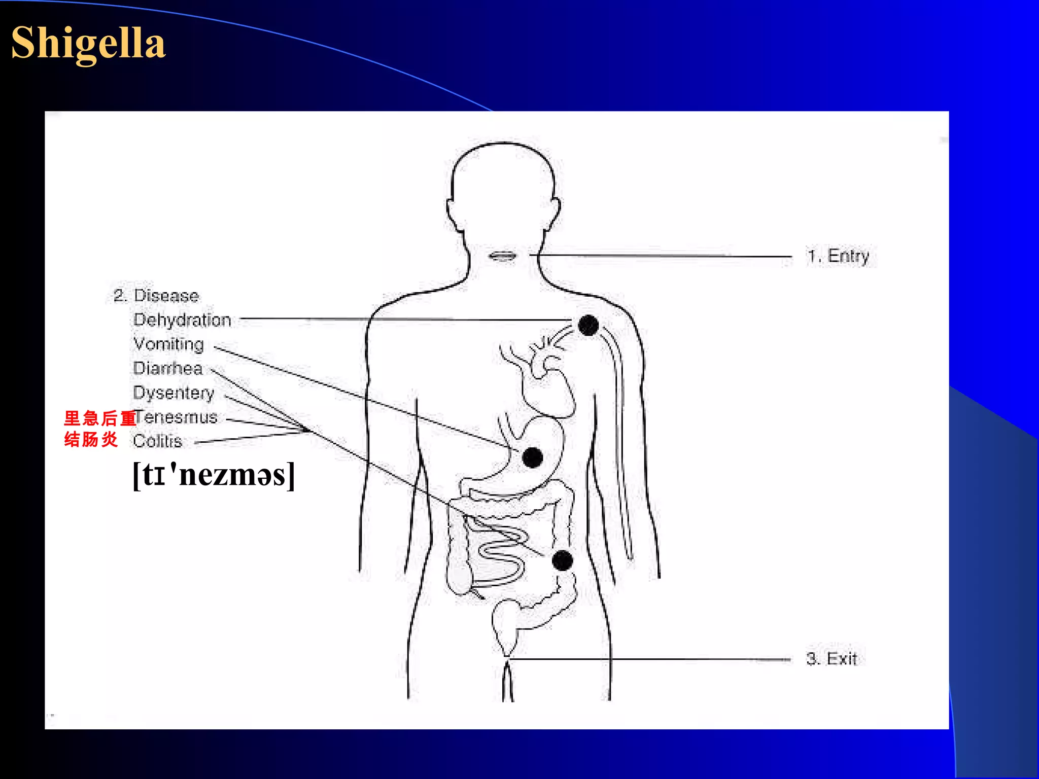 Shigella
里急后重
结肠炎
[t 'nezməs]ɪ
 