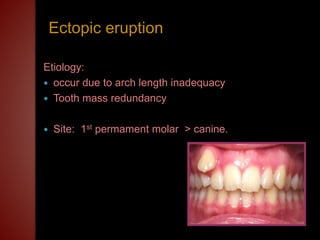 Eruption, shedding & teething problems | PPTX