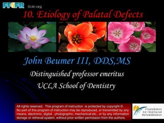 10. Etiology of Palatal Defects



    John Beumer III, DDS,MS
         Distinguished professor emeritus
           UCLA School of Dentistry

All rights reserved. This program of instruction is protected by copyright ©.
No part of this program of instruction may be reproduced, or transmitted by any
means, electronic, digital , photographic, mechanical etc., or by any information
storage or retrieval system, without prior written permission from the authors.
 