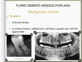 FLORID CEMENTO-OSSEOUS DYSPLASIA
-Radiographic Features
Periphery-
Sclerotic border
In mature lesions, radiolucent, soft-tissue capsule may NOT be
appreciable
104
 