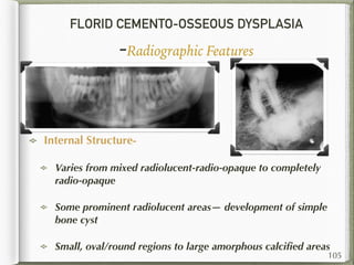 FLORID CEMENTO-OSSEOUS DYSPLASIA
-Radiographic Features
Internal Structure-
Varies from mixed radiolucent-radio-opaque to completely
radio-opaque
Some prominent radiolucent areas— development of simple
bone cyst
Small, oval/round regions to large amorphous calciﬁed areas
105
 